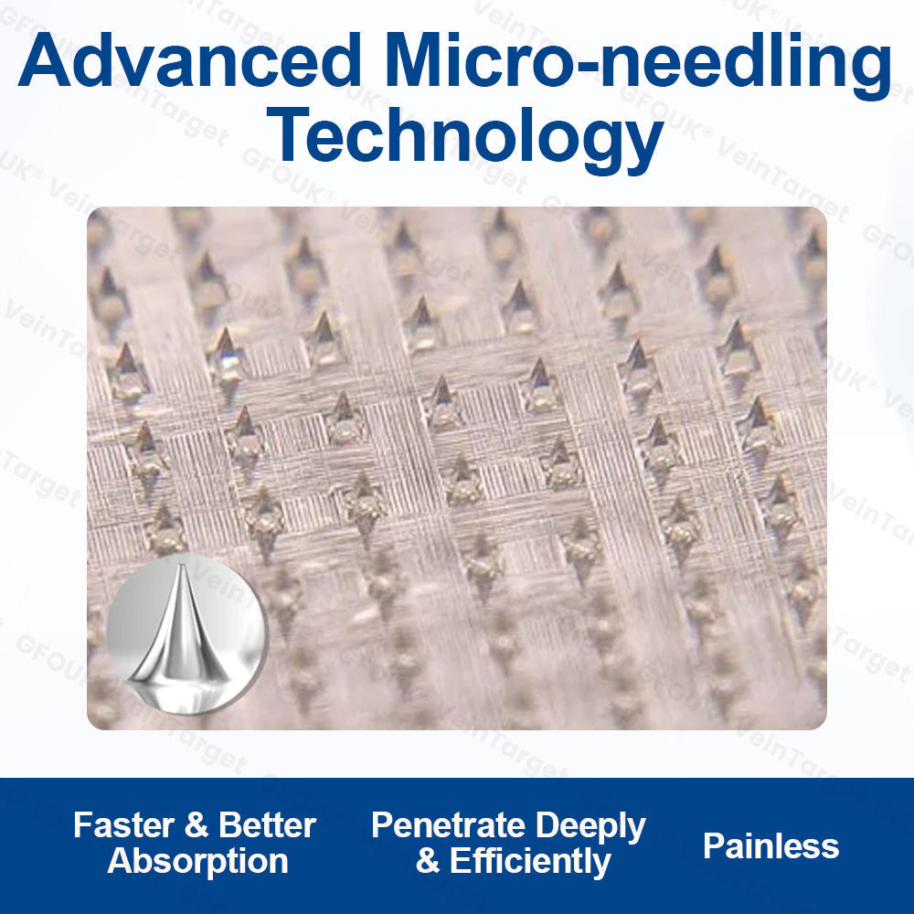 🇬🇧👨⚕️✨ CURALONA® VeinTarget Microneedle Patch ⚡ Fast Relief, Long-Lasting Support