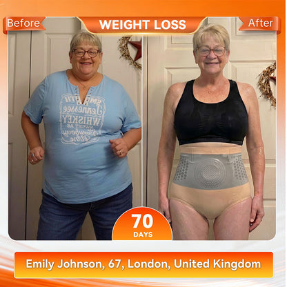 Official Brand Store | 𝓵𝓾𝓬𝓴𝔂𝓼𝓸𝓷𝓰® 2026 4-in-1 Shaping and Fat-Burning Shorts with Moringa and Berberine