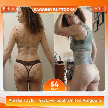 Official Brand Store | 𝓵𝓾𝓬𝓴𝔂𝓼𝓸𝓷𝓰® 2026 4-in-1 Shaping and Fat-Burning Shorts with Moringa and Berberine