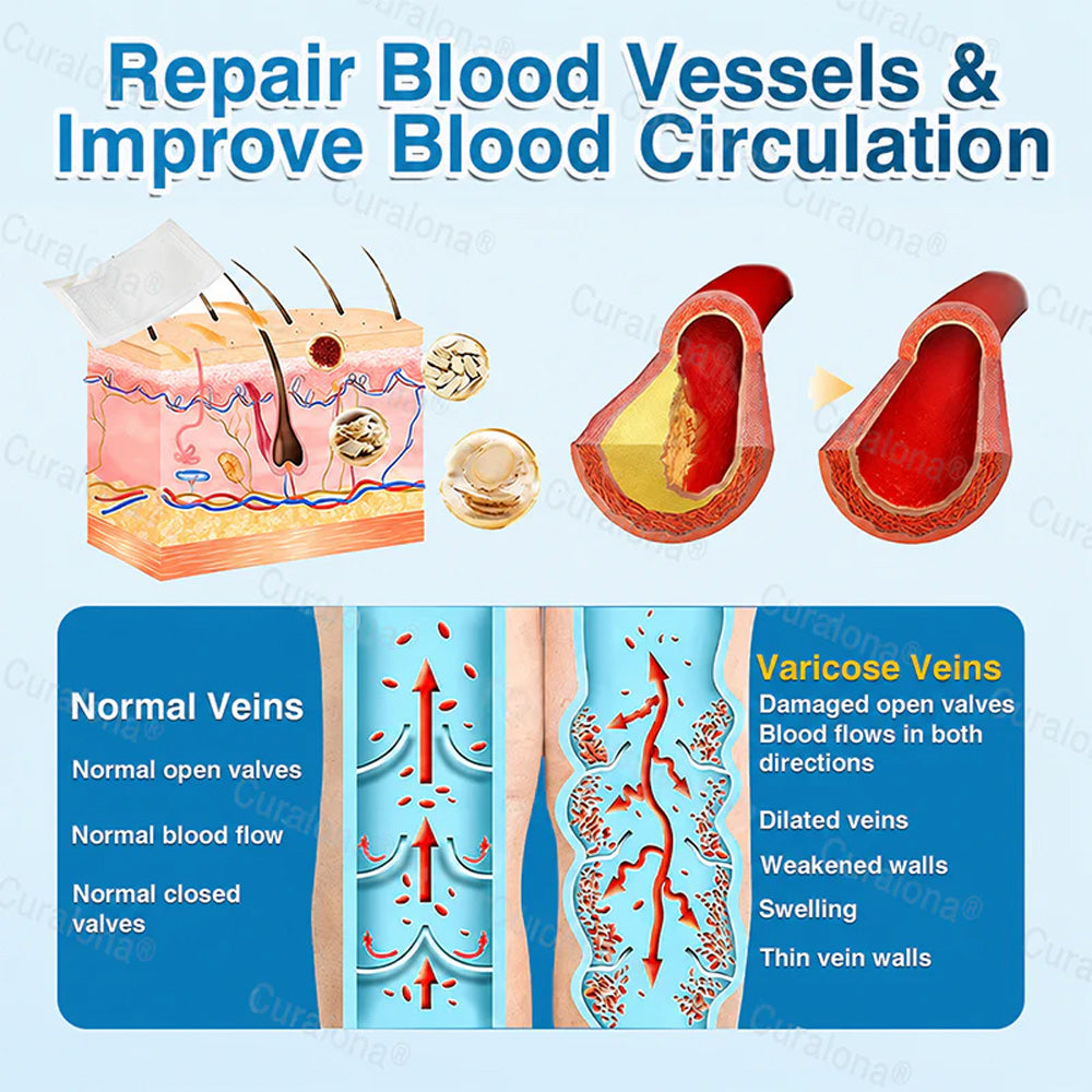 🇬🇧🏆✅️🏃 Curalona® VeinRepair Microneedle Patch Roll ⚡ Instant Relief, Long-Term Results