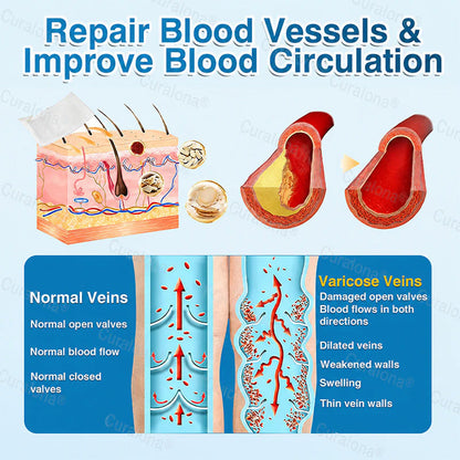 🇬🇧🏆✅️🏃 Curalona® VeinRepair Microneedle Patch Roll ⚡ Instant Relief, Long-Term Results