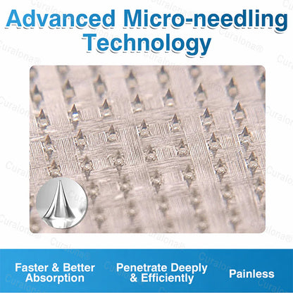 🇬🇧🏆✅️🏃 Curalona® VeinRepair Microneedle Patch Roll ⚡ Instant Relief, Long-Term Results