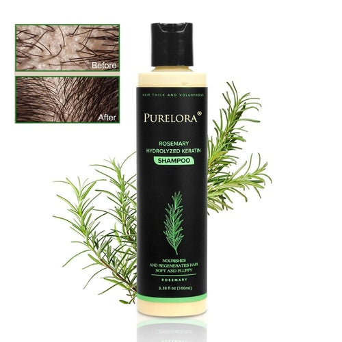 🔥LAST DAY 75% OFF⚡ Purelora® Organic Rosemary Hair Growth Shampoo