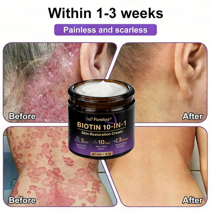 Made and Shipped from the UK 🍁 Purelora® Biotin 10-in-1 Skin Repair Cream — Last Day of Sale: 90% Off
