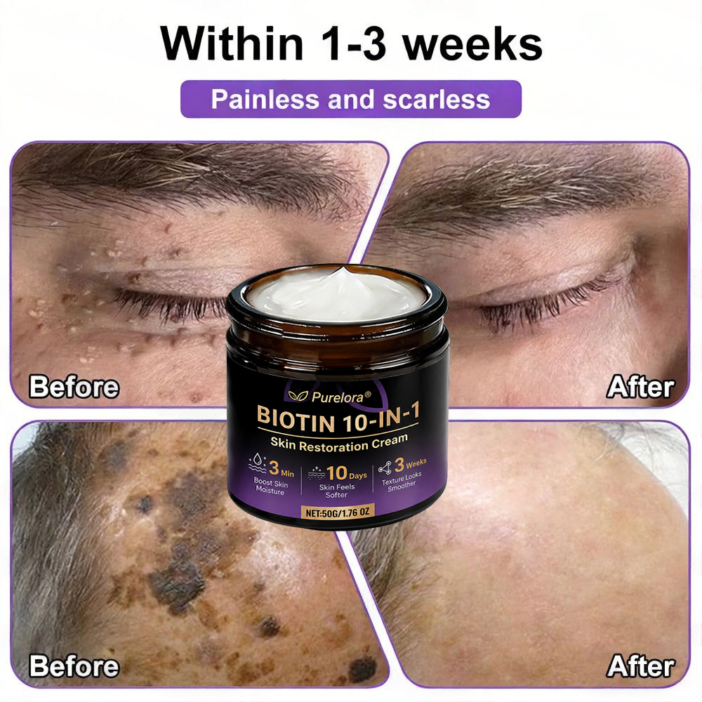 Made and Shipped from the UK 🍁 Purelora® Biotin 10-in-1 Skin Repair Cream — Last Day of Sale: 90% Off