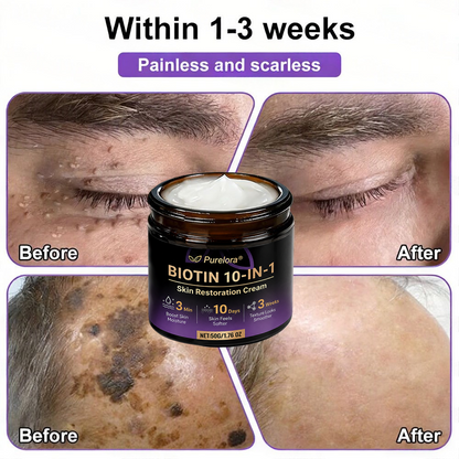Made and Shipped from the UK 🍁 Purelora® Biotin 10-in-1 Skin Repair Cream — Last Day of Sale: 90% Off