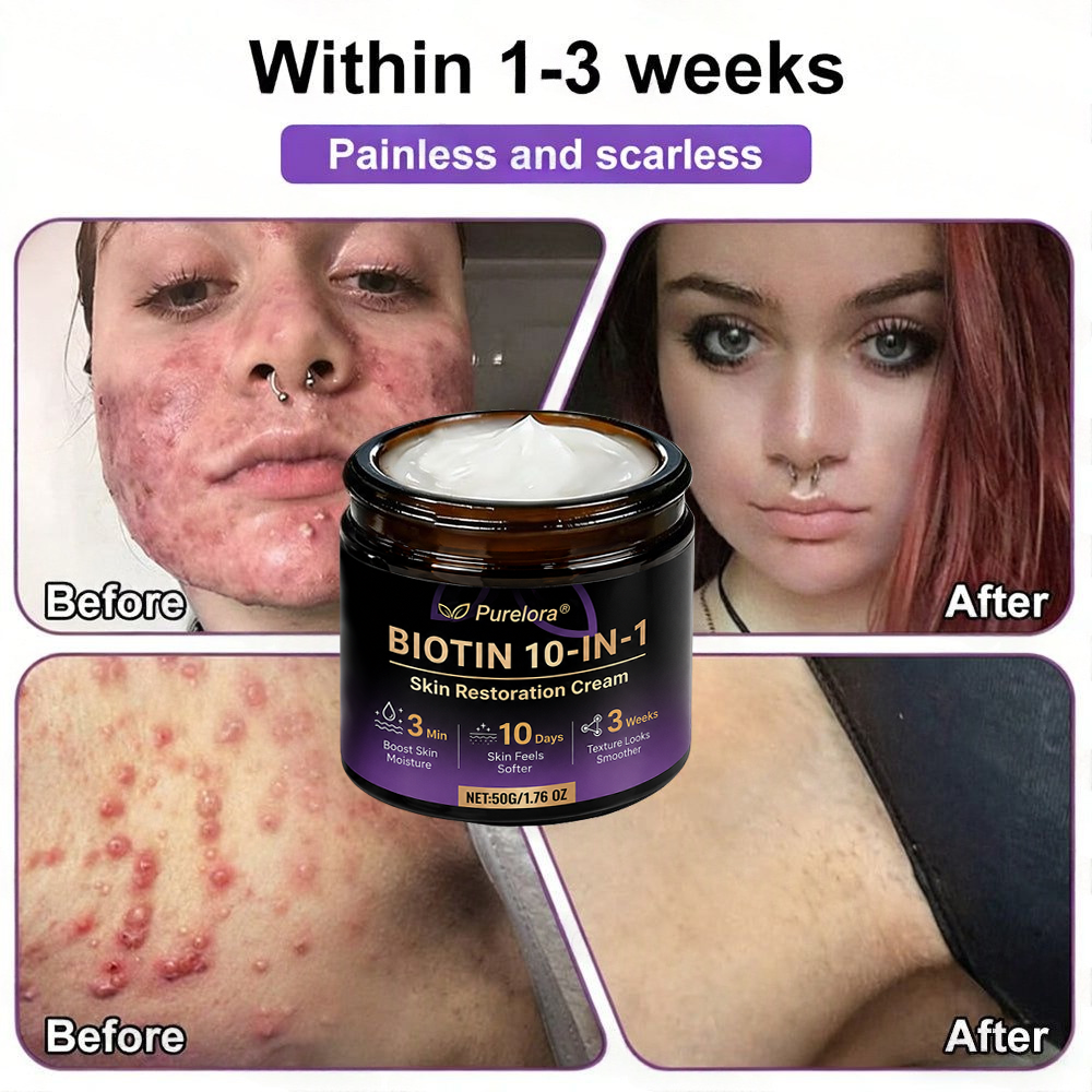 Made and Shipped from the UK 🍁 Purelora® Biotin 10-in-1 Skin Repair Cream — Last Day of Sale: 90% Off