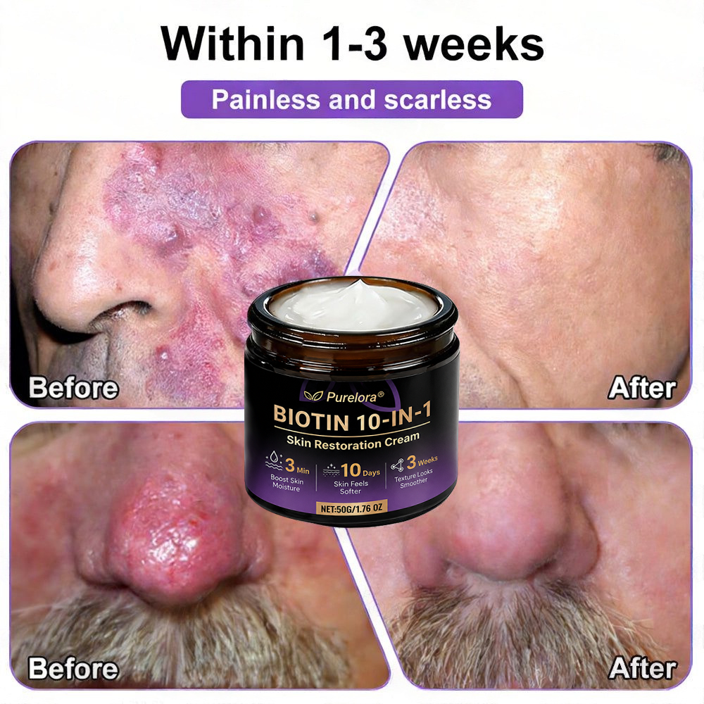 Made and Shipped from the UK 🍁 Purelora® Biotin 10-in-1 Skin Repair Cream — Last Day of Sale: 90% Off