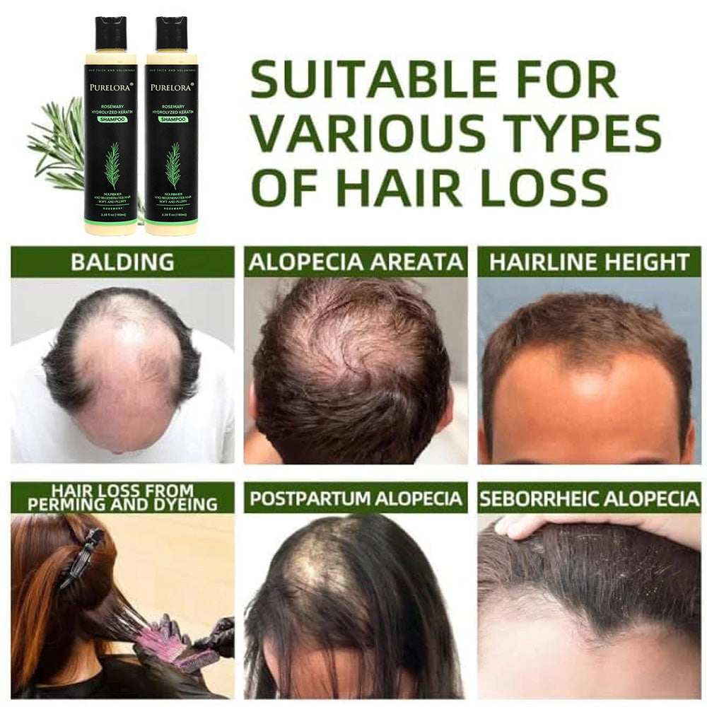 🔥LAST DAY 75% OFF⚡ Purelora® Organic Rosemary Hair Growth Shampoo
