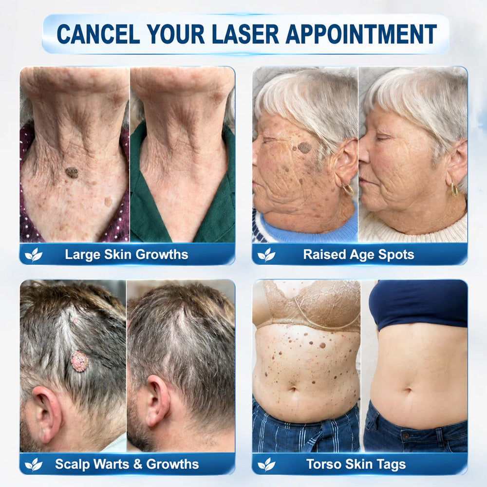 𝐏𝐔𝐑𝐄𝐋𝐎𝐑𝐀® 𝟕-𝐃𝐚𝐲 𝐒𝐤𝐢𝐧 𝐓𝐚𝐠 & 𝐒𝐩𝐨𝐭 𝐑𝐞𝐦𝐨𝐯𝐚𝐥 𝐂𝐫𝐞𝐚𝐦 (𝐏𝐚𝐢𝐧𝐥𝐞𝐬𝐬 𝐅𝐨𝐫𝐦𝐮𝐥𝐚 – 𝐍𝐨 𝐒𝐜𝐚𝐫𝐫𝐢𝐧𝐠) 🌹🌹