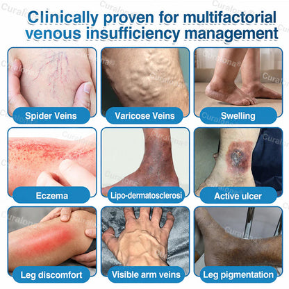 🇬🇧🏆✅️🏃 Curalona® VeinRepair Microneedle Patch Roll ⚡ Instant Relief, Long-Term Results