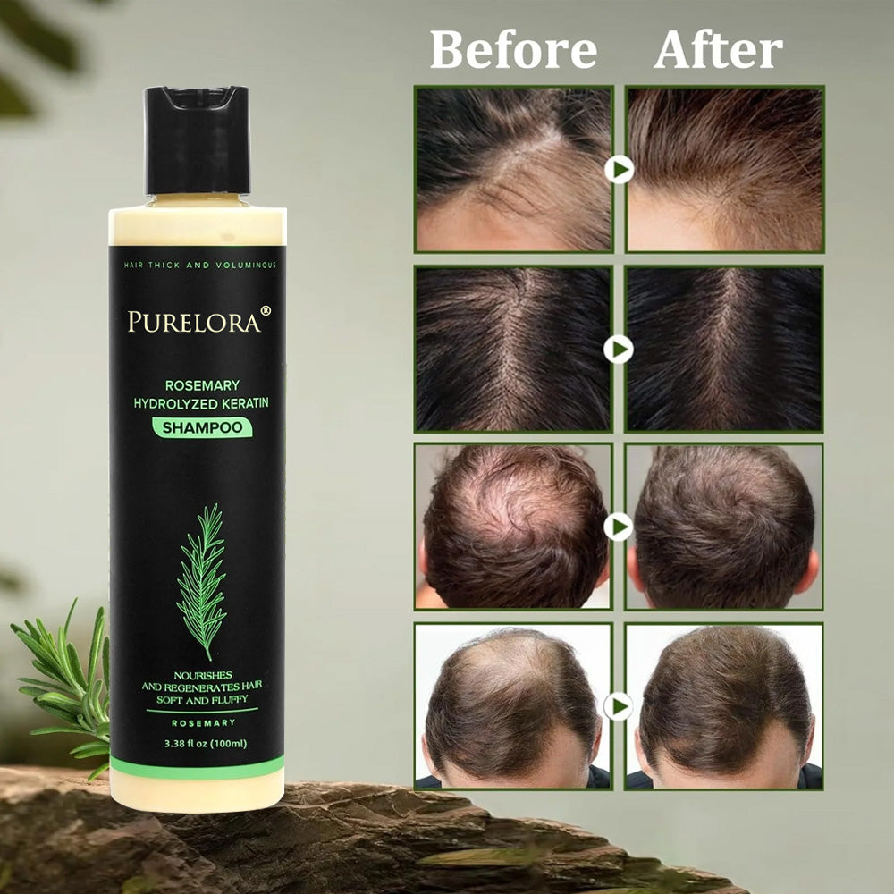 🔥LAST DAY 75% OFF⚡ Purelora® Organic Rosemary Hair Growth Shampoo