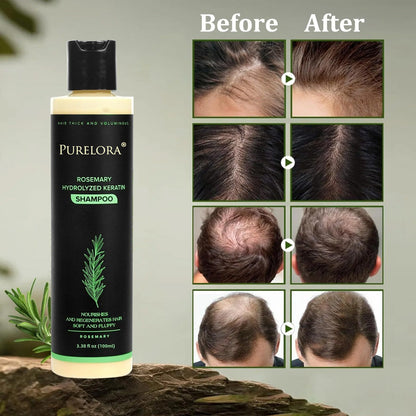 🔥LAST DAY 75% OFF⚡ Purelora® Organic Rosemary Hair Growth Shampoo