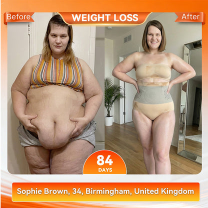 Official Brand Store | 𝓵𝓾𝓬𝓴𝔂𝓼𝓸𝓷𝓰® 2026 4-in-1 Shaping and Fat-Burning Shorts with Moringa and Berberine
